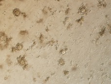 小鼠精子受精力检测