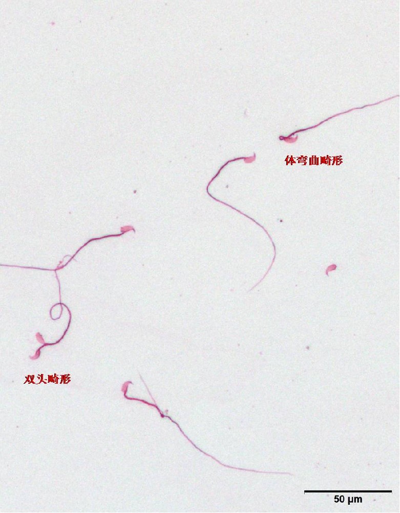 小鼠精子畸形检测服务